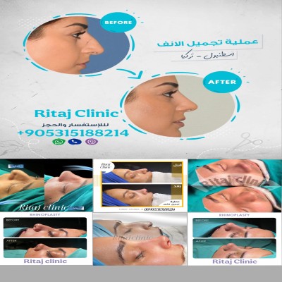 استشاري التجميل فادي في تركيا